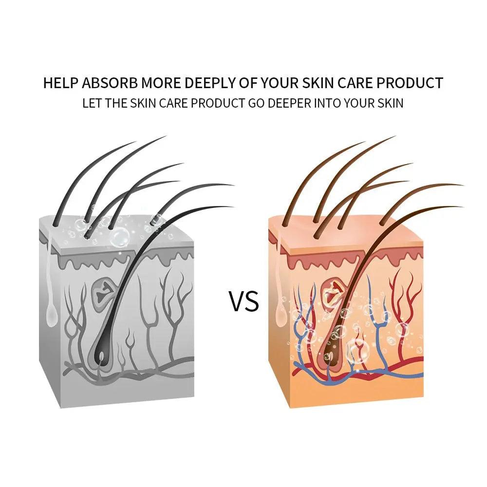 Facial Mesotherapy Electroporation RF Radio Frequency LED Photon Face Lifting Tighten Wrinkle Removal Skin Care Face Massager Fit For Life Brands