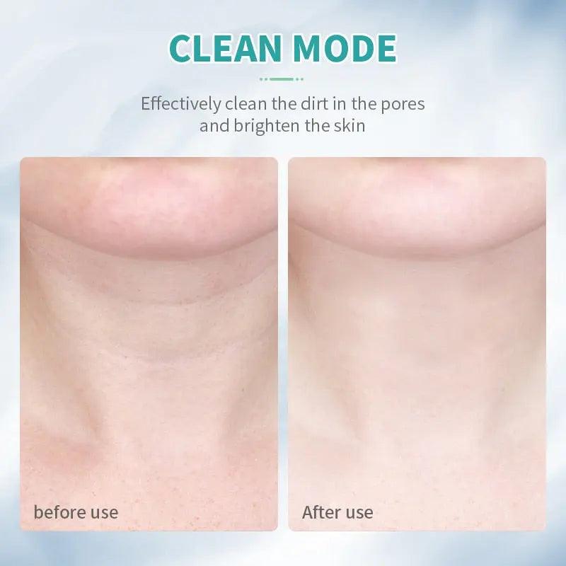 Neck Face Beauty Device Fit For Life Brands