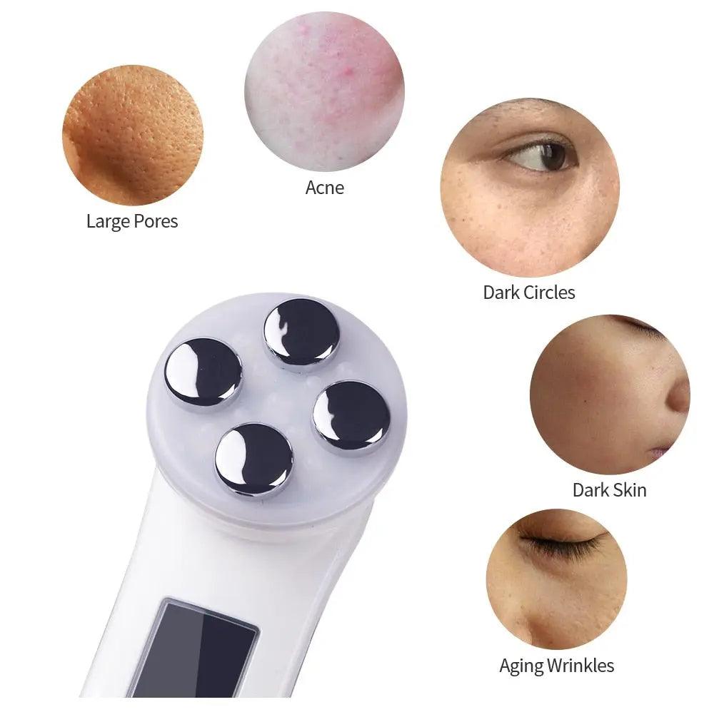 Facial Mesotherapy Electroporation RF Radio Frequency LED Photon Face Lifting Tighten Wrinkle Removal Skin Care Face Massager Fit For Life Brands 